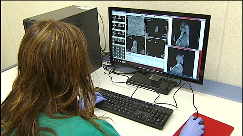 Un estudio de la Universidad de Oviedo abre la puerta a nuevos tratamientos contra la aterosclerosis